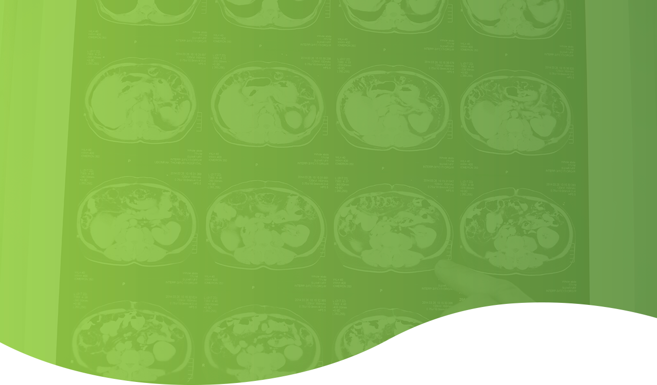 Tomografia UNO Diagnóstico